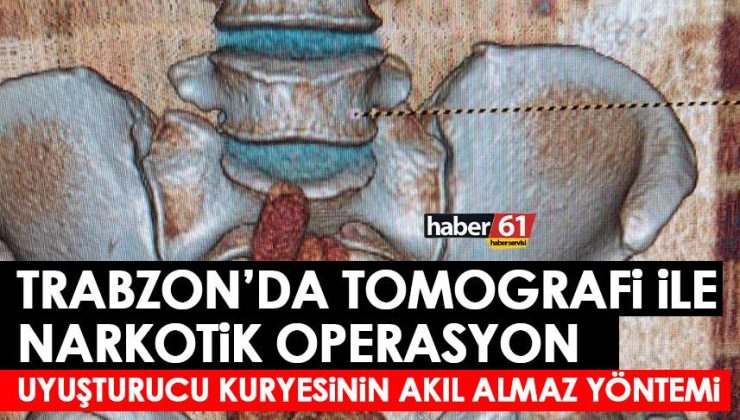 Trabzon’da uyuşturucu kaçakçısının inanılmaz yöntemi! Tomografi sonrası yakalandı